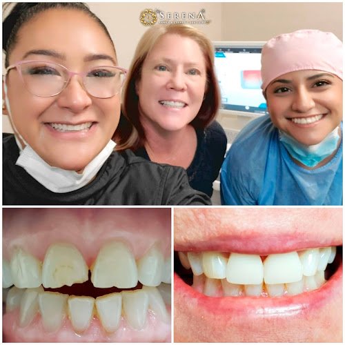 Serena San Diego Dentist