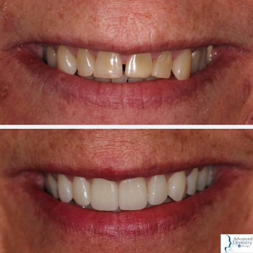 Advanced Dentistry by Design