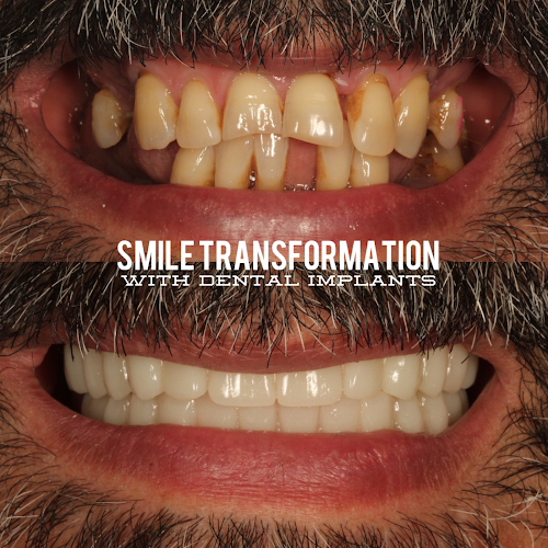 NC Prosthodontic Specialists