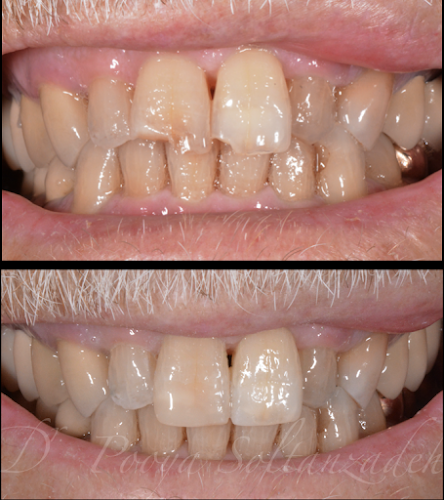 Orange County Prosthodontics