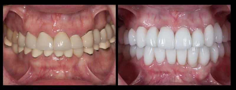 Center for Implant & Esthetic Dentistry: Ramin Mahallati, DDS