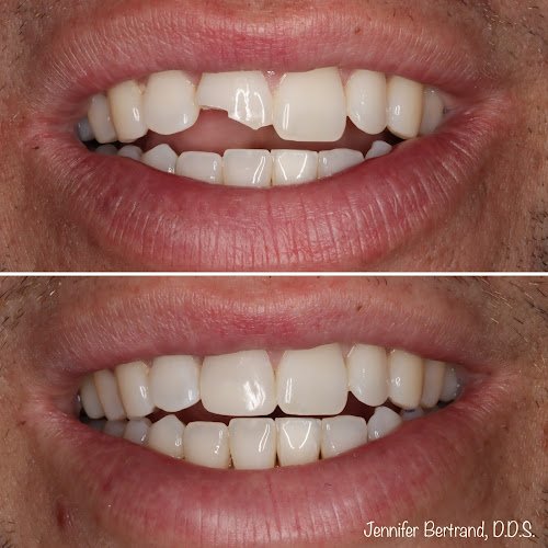 Smile Design Dentistry