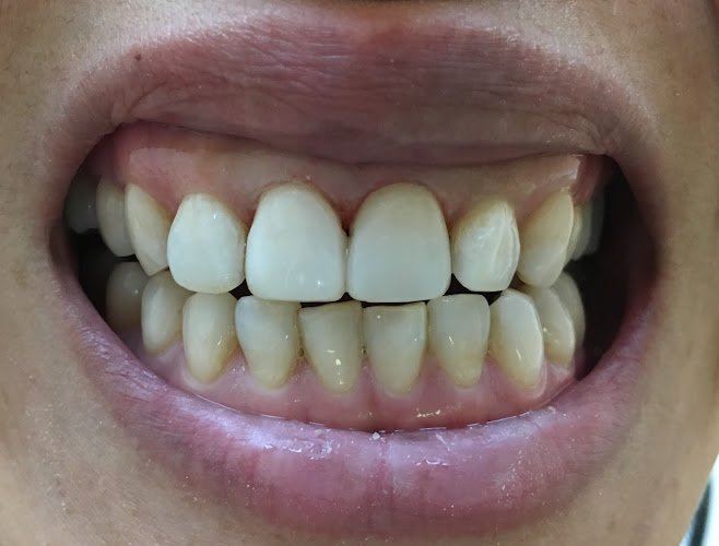 Menlo Park Dental Excellence