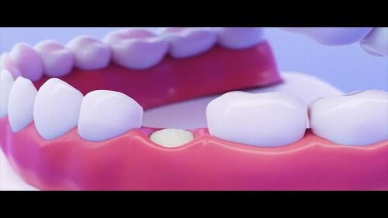 CA Periodontics & Implant Clinic