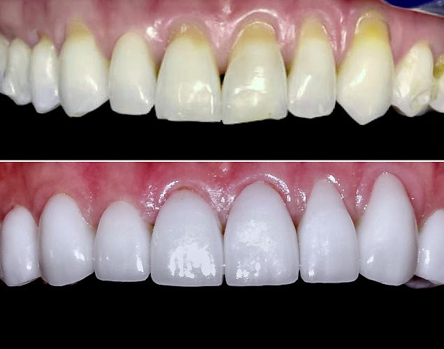 Joshua Perlman, D.M.D, NYC Smile Spa