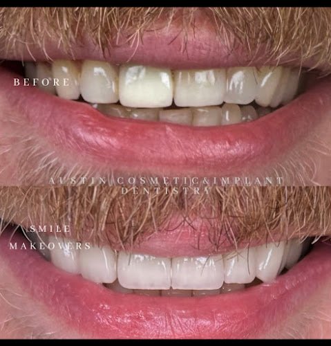 Austin Cosmetic & Implant Dentistry