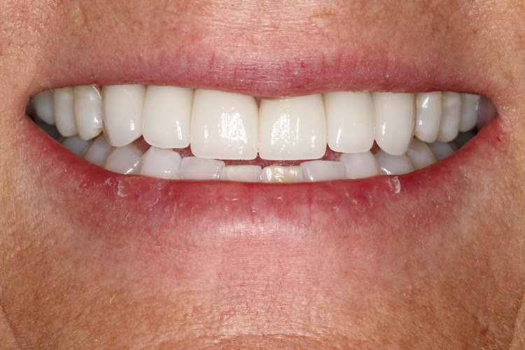 Telluride Center for Dentistry – Telluride Dental