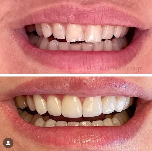 MK Dental Group