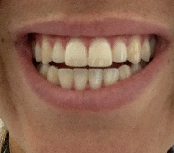 Open and Affordable Dental Cherry Creek