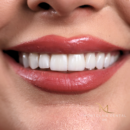 Montclair Dental Spa