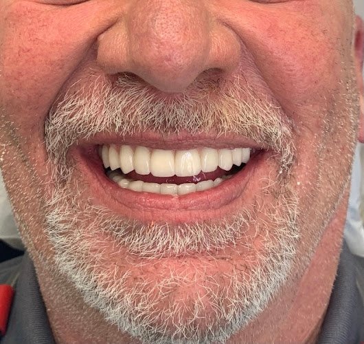 Texas Implant & Dental Center