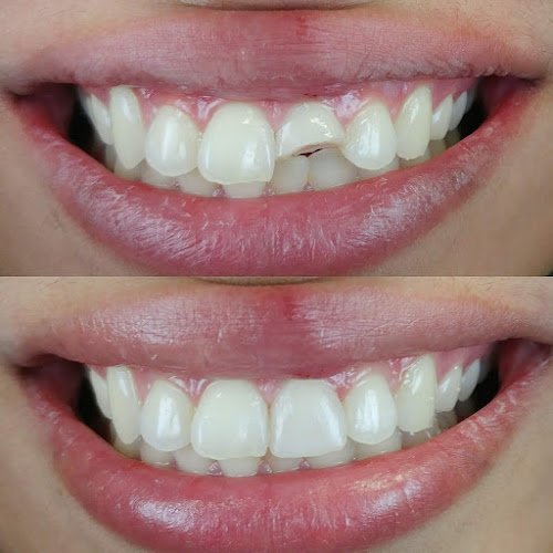 Apple Valley Dental Associates