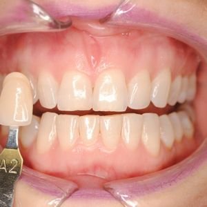 Bollinger Canyon Dental