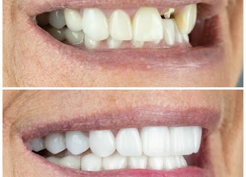 xr:d:DAFQDF9oliA:10,j:39014678165,t:22102514