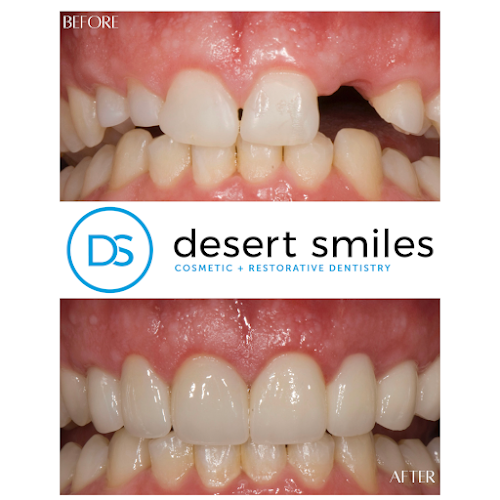 Desert Smiles Cosmetic & Restorative Dentistry