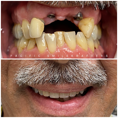 Pacific Smilekrafters