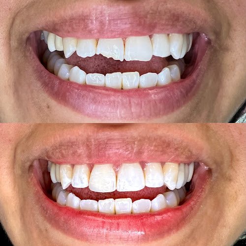 Delgado Dental Group