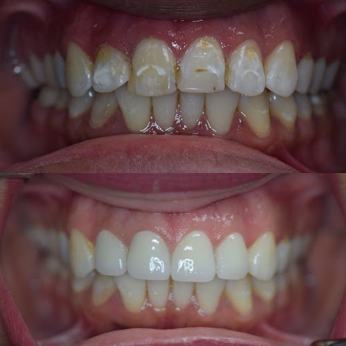 Elite Dentistry of Simi Valley – Simi Valley Dentist