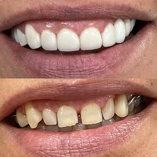 Pico Rivera Dental Smiles