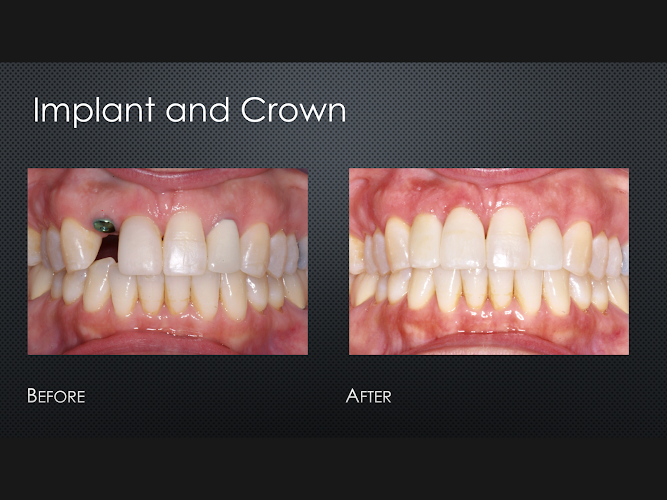 Smiles For Life- Dr. Nate Heffelfinger