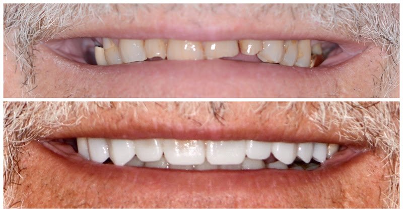 Raines Over The Rockies Family Dentistry