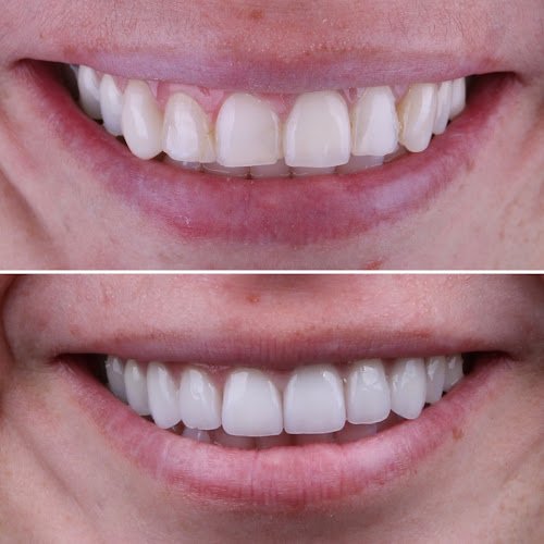 Islay Hill Dentistry Co.