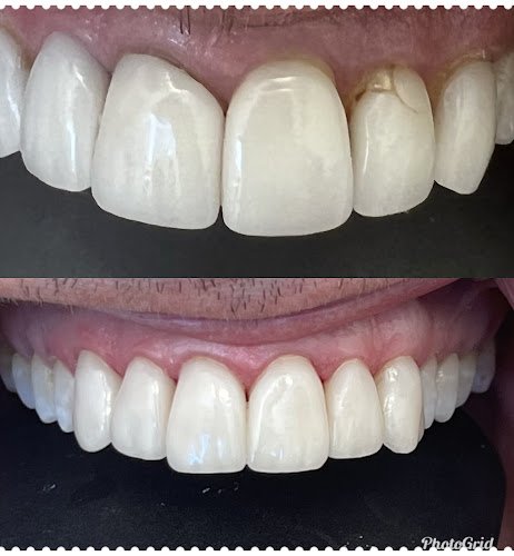 Oshin Anjirghooli, DMD