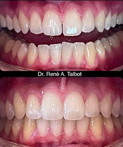 René A. Talbot, Cosmetic Dentistry & Facial Aesthetics