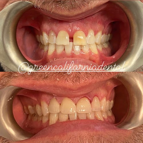 Green California Dental Group: Varand Kerikorian, DDS