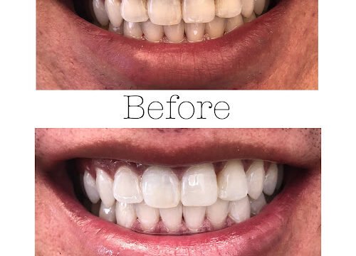 created by photogrid