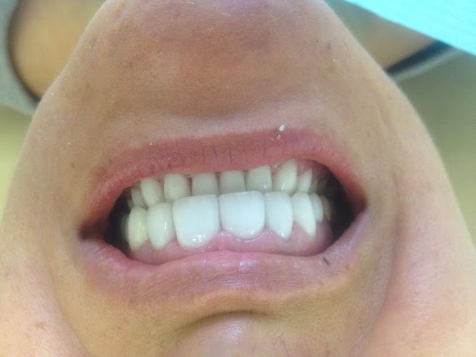 Pure Dental of Murrieta & Orthodontics