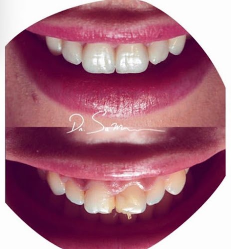 City Dental Centers Pico Rivera, CA – Dentist in Pico Rivera