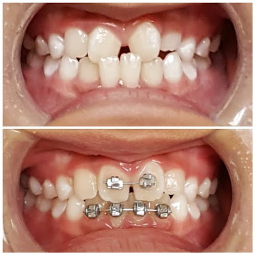 Warner Dental – Fountain Valley