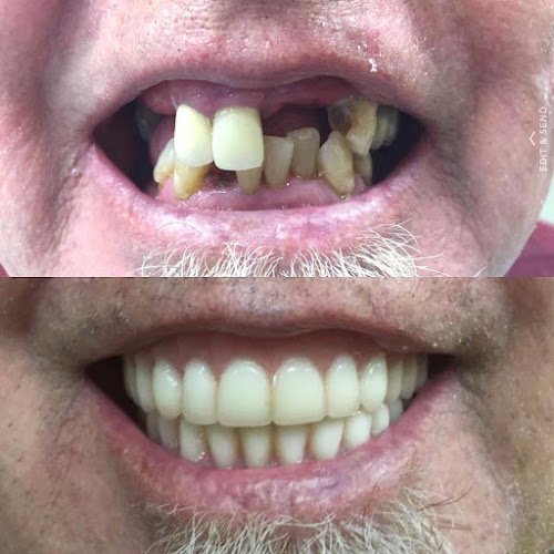 Singing Hills Dentistry El Cajon