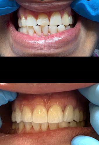 Dentist Downey – Orange Estates Dental