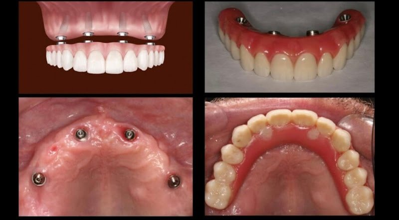 California Smile Dental Group