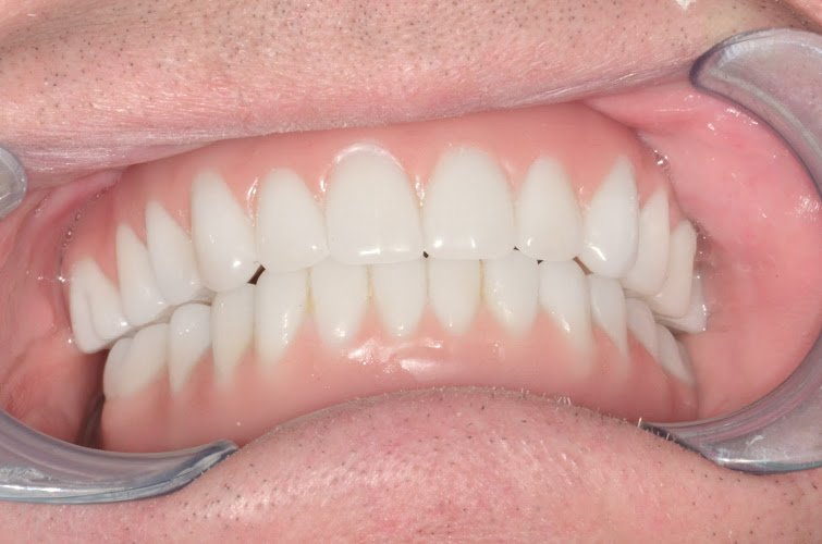 Memphis Dental Implant Surgery Center