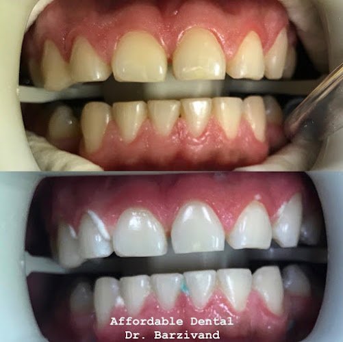 Affordable Dental