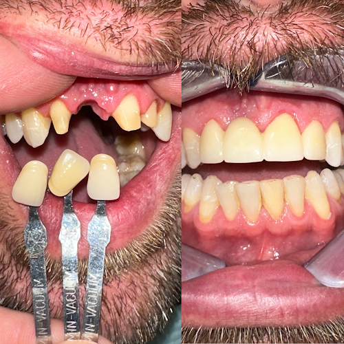 Sunset Family Dentistry