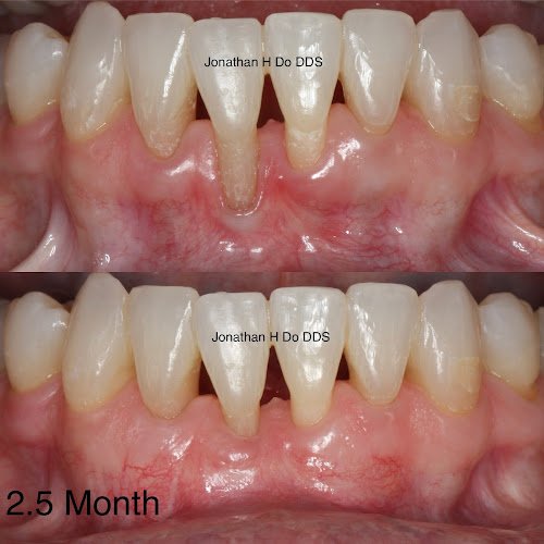 Jonathan H. Do, DDS: Board-Certified Periodontist