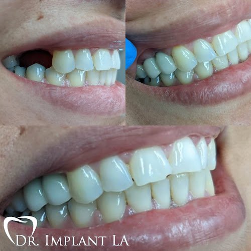 Whittier Dental Center