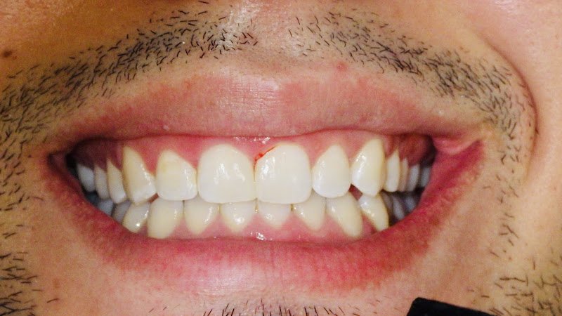 Downey Dental Solutions