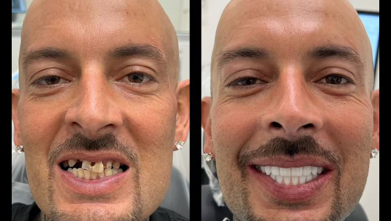 Global Implant Dentistry