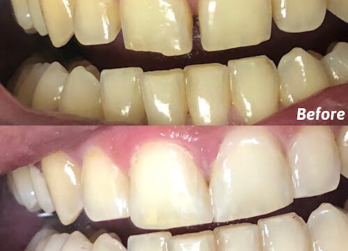 Processed with MOLDIV