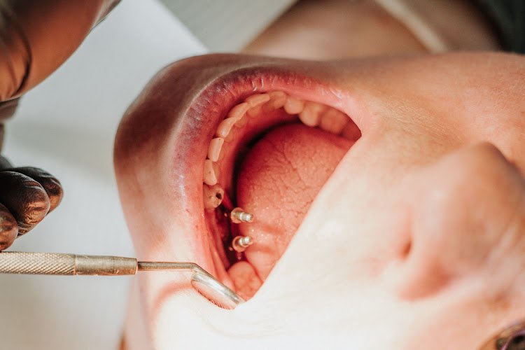 Dental & Implant Centers of Colorado