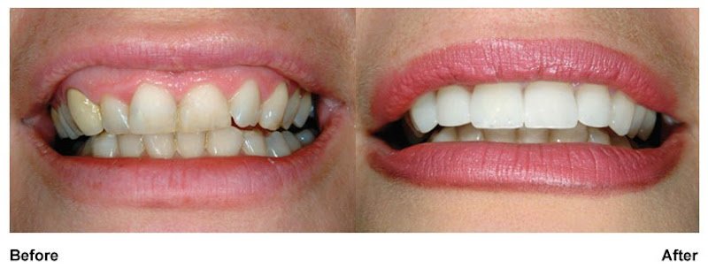 Dental Group of Meriden-Wallingford