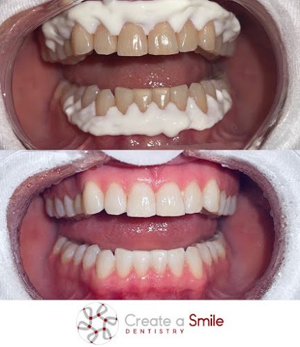 Create A Smile Dentistry – Dr. Ken Moore