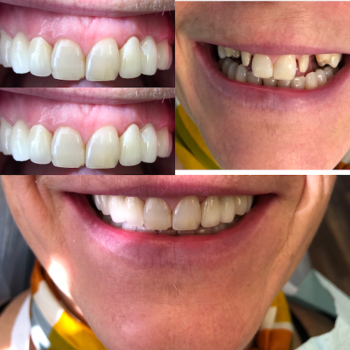 Bright Dental – La Mirada – Location