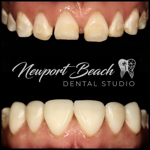 Newport Beach Dental Studio
Dr. Tai Ha, DDS