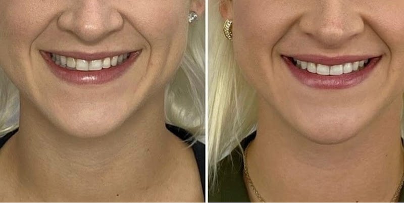 California Dental Design